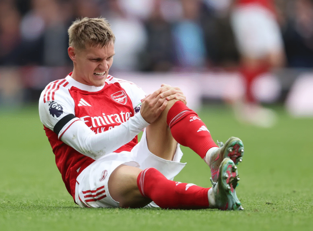 image-568-1024x757 Coup de pouce majeur pour Arsenal en vue du derby du nord de Londres : Odegaard devrait faire son retour contre Tottenham après la blessure de Gabriel.